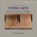 비앤에스 | [강남 피부과 추천] 삼성비앤에스의원 강남 강남 피부과 추천 - 효과 좋은 시술