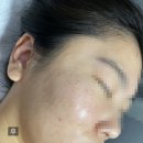 신중동왁싱/피부관리 라인블리 팔하프제모와 비타민피부관리 후기!