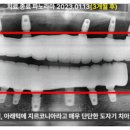 해인치과기공소 이미지