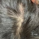 닥터그루트 마이크로바이옴 엑소좀 샴푸 후기