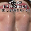 가꾸는동안안산고잔더하이브점 | 안산 피지압출 잘하는 샵 | 가꾸는동안 안산고잔더하이브점