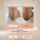 로라뷰티(Rora Beauty) | 청주 발각질제거 잘하는 곳 봉명동 '로라제이' 솔직후기