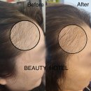 뷰티호텔 이미지