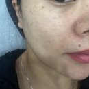 청수한의원 | [청당동 메이비유에스테틱] 여드름 피부고민 제대로 관리받고 온 후기