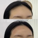 [후기] 울산 여자 헤어라인 왁싱 잘하는곳 - 재재방문한 코우너, 믿고 가는 코우너