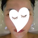 상암피부관리 여우스킨 상암점에서 수분 집중케어 후기