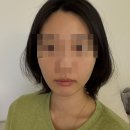 스테이영피부과의원 | 광진구 피부과 리프팅 후기, 얼굴 맞춤 설계라 믿음 갔던 곳