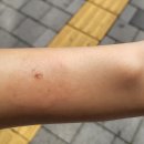 연세영피부과의원 네이버블로그