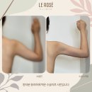 르로제의원 네이버블로그