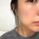 고주파 | 트리폴라 고주파 후기 스탑 브이엑스 2 디바이스 10일 챌린지