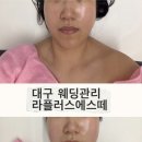 한중한방병원 | 대구웨딩관리는 라플러스에스떼┃아쿠아필, 윤곽관리 (추가금 내돈내산)