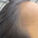 헤어루미 - 속초시 | 얼굴이 작아보이는 수성구 범어동 루미뷰티 헤어라인 후기