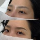 서울대입구 눈썹문신 후기 : 초잉브로우 (수지눈썹)