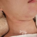 예쁠래에스테틱 이미지