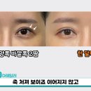 두땀