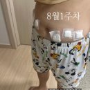 리라언니 | 삼성동피부과 복부지방분해주사 리라주사 1회 후기