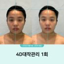 해운대/센텀 웨딩관리 | 작은얼굴 추천 | 고운빛깔 센텀점