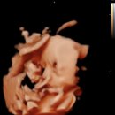 11545-10-25-28 | 임신 중기 후반 25~28주 증상 총정리｜태동·딸꾹질·체력저하 실감