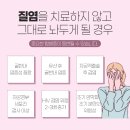 경우 이미지