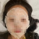 본가한의원 | 서울 강남 한의원 추천ㅣ연휴 맞이 기미 레이저 1주차 후기