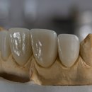 이건치과기공소 이미지