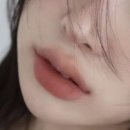 오빗의원 | 압구정 오빗의원 입술필러 맞은 후기