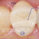 밝은이치과기공소 이미지