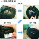 인삼당한의원 네이버블로그