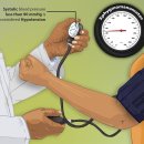 저혈압 [low blood pressure] 이미지