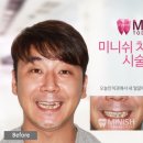 미니쉬치과기공소 이미지