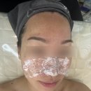 나래샵 | 문제성, 여드름피부 전문관리샵 빛나래에스테틱_색소침착, 모공 플라즈마 후기
