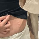 행복한차정비 | 내돈내산 신촌제로팻후기 4회차 신촌옆구리지방분해주사 후기