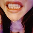 신논현역치아미백잘하는곳 추천 받아서 난생처음 강남치아미백 경험한 후기~