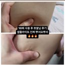아셀홈케어 이미지