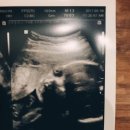 레몬산부인과의원 이미지