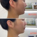 (주)토미시스템 | 불당동윤곽관리 제대로 받았어요🔥 천안 얼굴관리 · 웨딩관리 고민 중이면 아나토미 에스테틱 추천