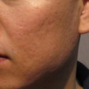 존스킨한의원 이미지