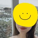 범계피부과 라마르의원 - 입술과 턱끝 필러 + 자갈턱 보톡스 내돈내산 후기!