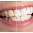 수정치과기공소 이미지