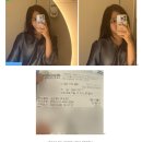 여드름피부도 가능한 2만원대 레이저리프팅 추천 [강남역 미술관피부과/물방울LDM 효과]