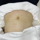 오구본가전주호성점 | 올가드림뷰티호성점 복부관리 실제효과