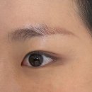 능하루 | 시흥 장곡동 능공역 눈썹문신제거 붉은잔흔 미작뷰티 시흥점 후기