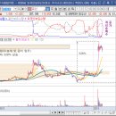 유신의료기 이미지