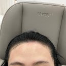 부평왁싱 잘하는 곳 르네뷰티왁싱 헤어라인 후기