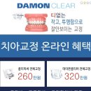 포샤르치과의원 | 강남역사랑니 임플란트도 강남역 포샤르 치과​