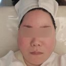 씨유(CU)강동천호대로점 | 스킨앤유 천호점 강동구피부관리 천호물방울고보습케어 후기