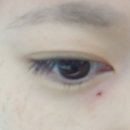 영드림의원 네이버블로그