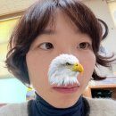 이노티안경 대구반월당점 | 대구 반월당피부과 피코토닝 1회차 내돈내산 후기