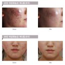 새서울메디칼 네이버블로그