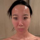 내안에 힐링스파 | 분당피부관리 6개월차 내돈내산관리,슈퍼젝션 니코티노이드 솔직후기,내안에 힐링스파